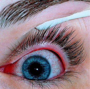 Nettoyer des lentilles de contact sans produit d'entretien