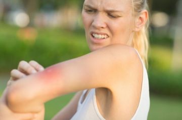 Moustiques : pourquoi piquent-ils certaines personnes plus que les autres ?