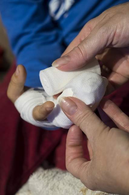 bandage d'une main brûlée