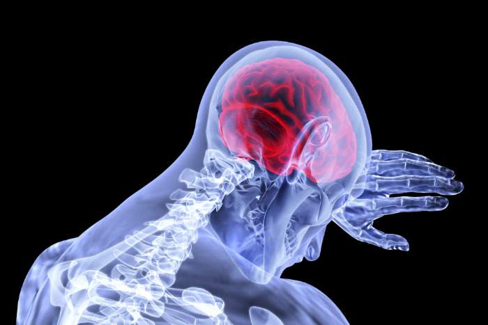 Accident Vasculaire Cérébral AVC symptômes et que faire
