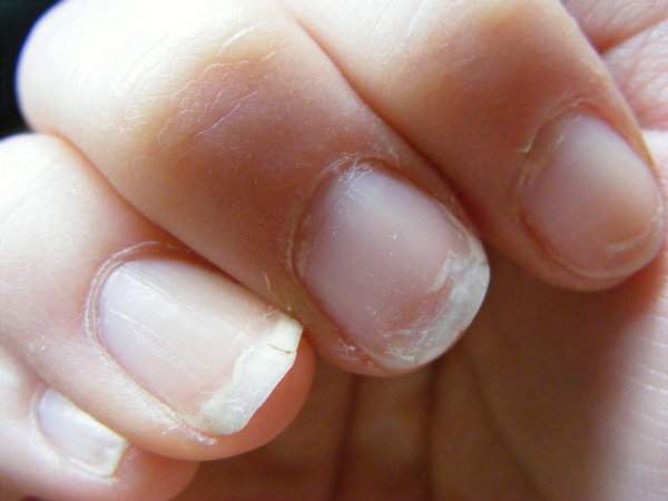 Ce que vos ongles révèlent sur votre santé