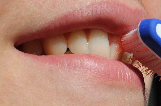 Prevenir la placa dental y el sarro