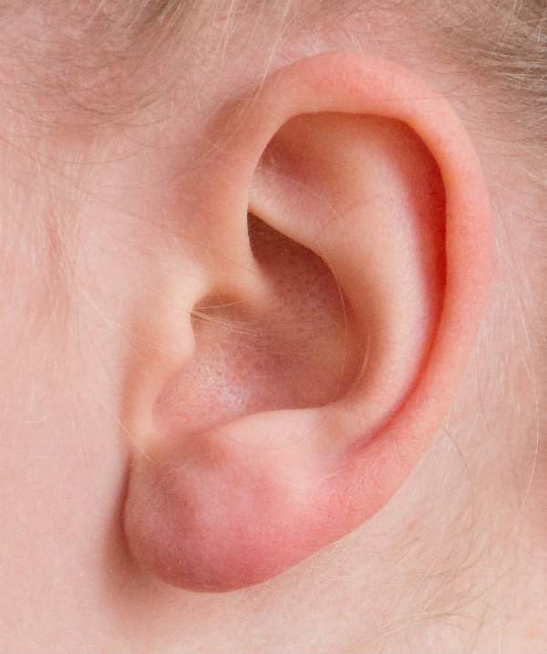 Remèdes naturels contre les douleurs d'oreilles