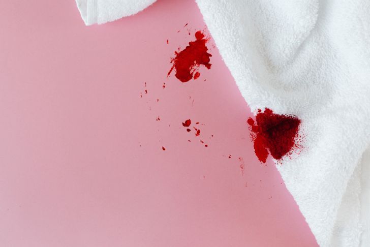 Comment enlever une tache de sang sur un vêtement