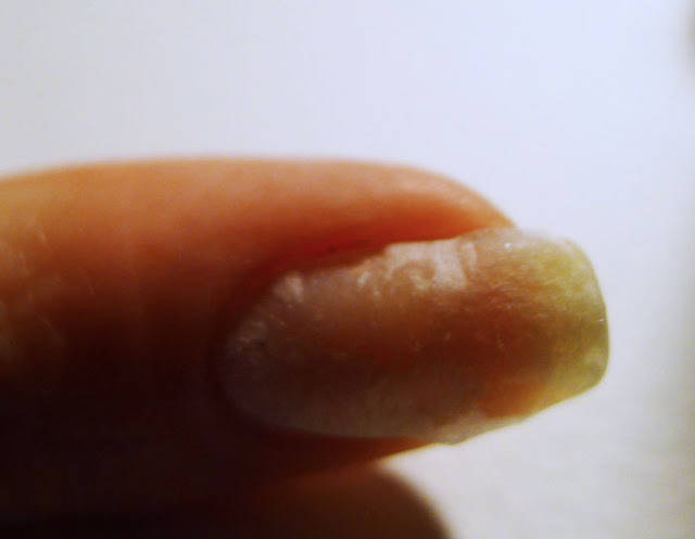 Réparer un ongle cassé avec un sachet de thé