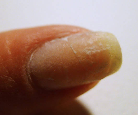 Réparer un ongle cassé avec un sachet de thé
