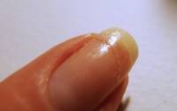 Réparer un ongle cassé avec un sachet de thé
