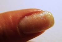 Réparer un ongle cassé avec un sachet de thé