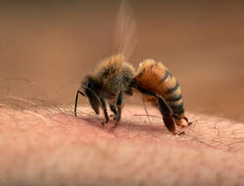 Soulager une piqûre d'abeille