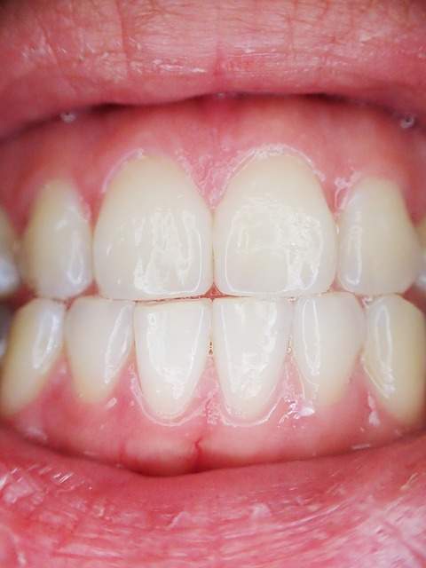 dents et gencives saines