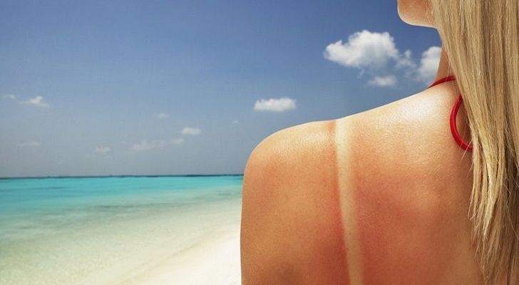 Traces de bronzage