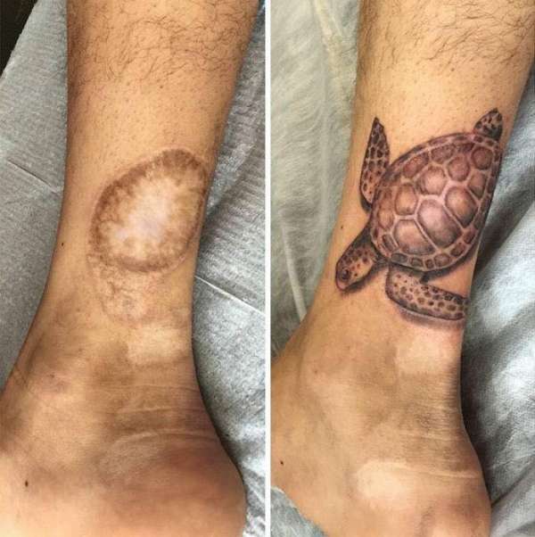 Un tatouage tortue de mer qui couvre parfaitement cette cicatrice