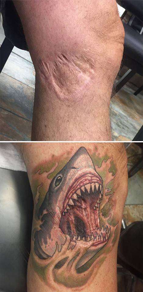 Un tatouage requin assoiffé de sang pour cacher une vilaine cicatrice