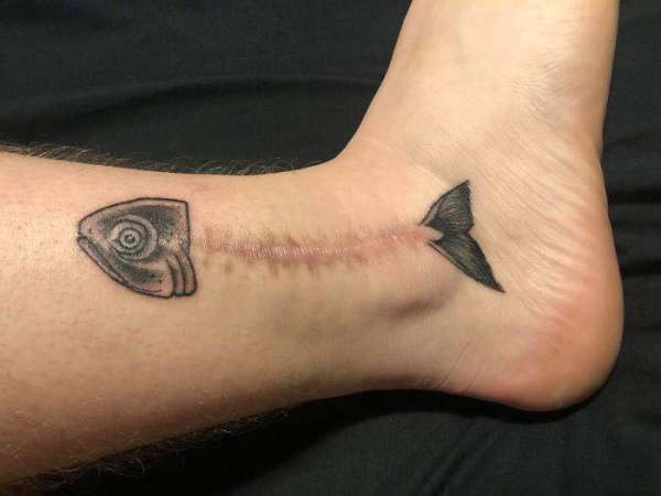 Un tatouage squelette de poisson bien réussi pour cacher cette cicatrice chirurgicale