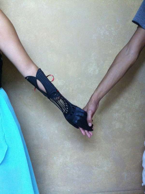 Un bras prosthétique très original