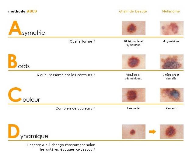 Surveiller ses grains de beauté