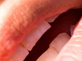 Qu’est ce qui peut causer la mauvaise haleine