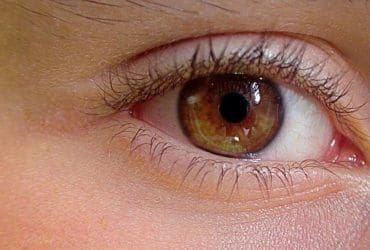 Que faire en cas de conjonctivite