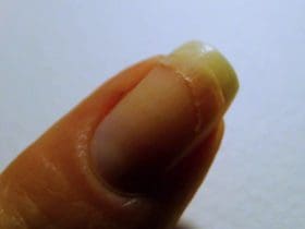 Réparer un ongle cassé avec un sachet de thé