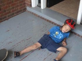 Les bons réflexes pour soulager les bleus les bosses et les hématomes