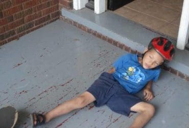 Les bons réflexes pour soulager les bleus les bosses et les hématomes