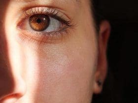 Remèdes naturels efficaces contre les taches brunes