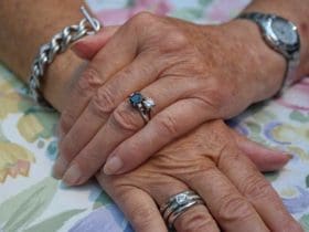 9 Remèdes pour enlever les taches brunes sur les mains naturellement