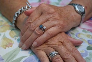 9 Remèdes pour enlever les taches brunes sur les mains naturellement