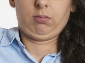 Eliminez naturellement le double menton