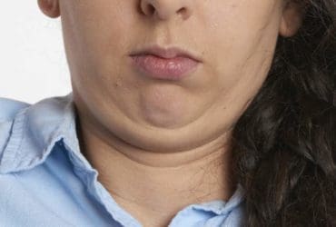 Eliminez naturellement le double menton