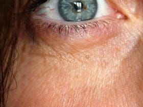 Astuces naturelles pour ralentir le vieillissement de la peau