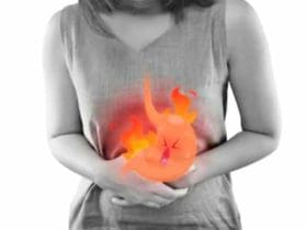 Conseils pour soulager les brûlures d'estomac