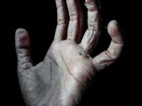 Astuces pour prévenir les mains sèches et gercées