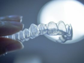 Pourquoi l'orthodontie invisible séduit autant ?