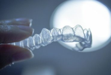 Pourquoi l'orthodontie invisible séduit autant ?