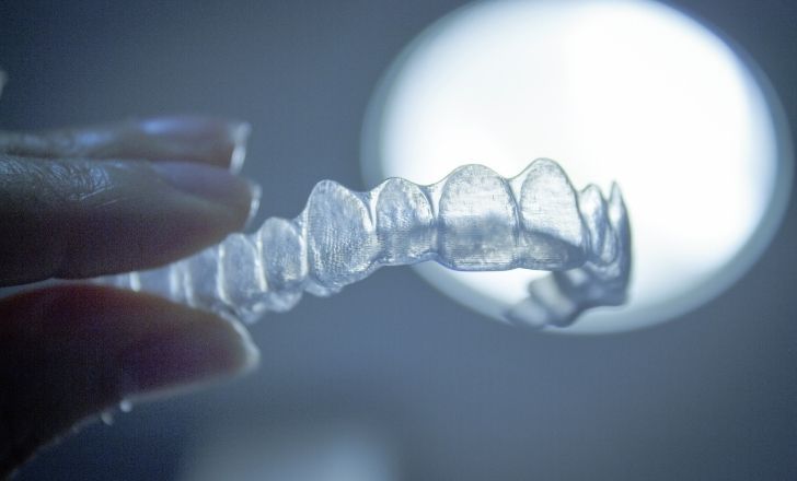 Pourquoi l'orthodontie invisible séduit autant ?