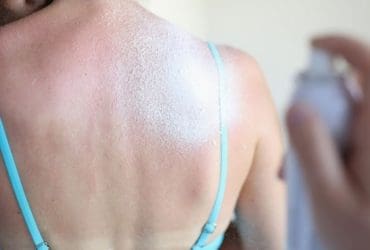 Comment nettoyer les taches de crème solaire sur les vêtements ?