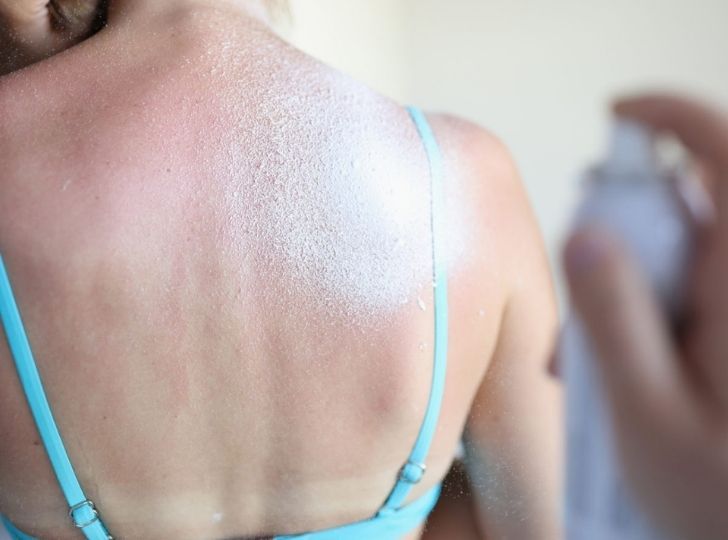 Comment nettoyer les taches de crème solaire sur les vêtements ?