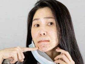 Port du masque : comment éviter les boutons sur le visage ?