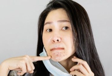 Port du masque : comment éviter les boutons sur le visage ?
