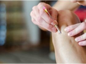 Comment enlever un poil incarné et prévenir son apparition