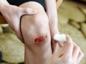 Comment favoriser et accélérer la cicatrisation ?