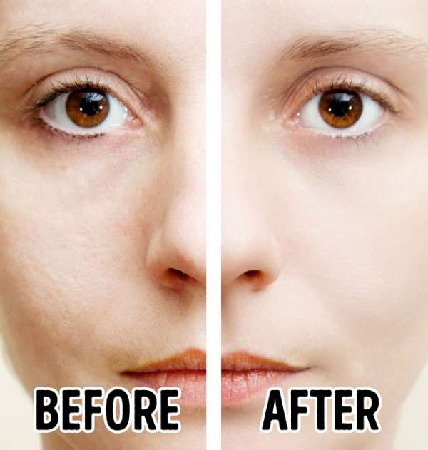 Appliquez de l'eau de riz sur votre peau pour réduire l'apparence des pores dilatés
