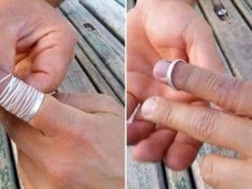 Enlever une bague coincée au doigt