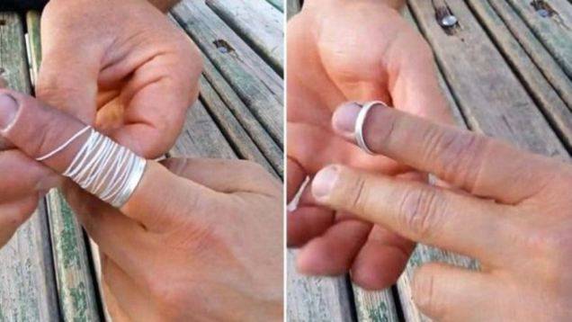 Enlever une bague coincée au doigt