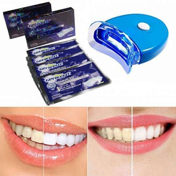 Kit pour blanchir les dents en 30 minutes