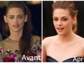 Astuces beauté quand on a des oreilles décollées