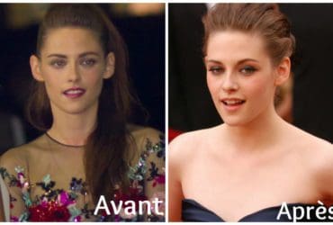 Astuces beauté quand on a des oreilles décollées